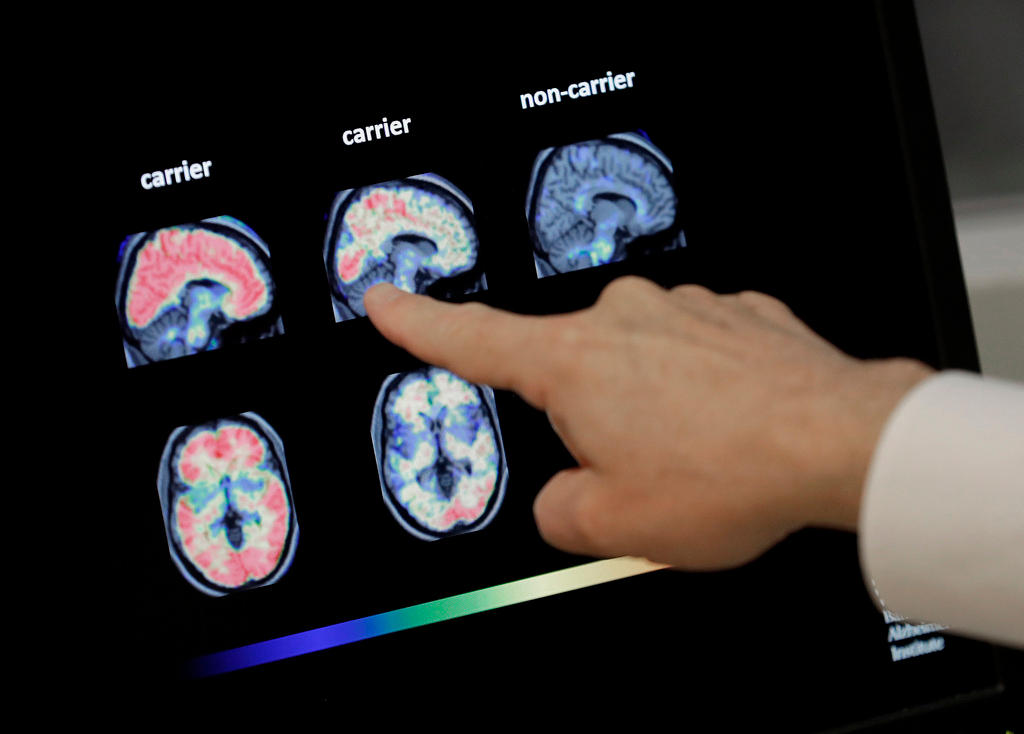 Fotos de escáner del cerebro