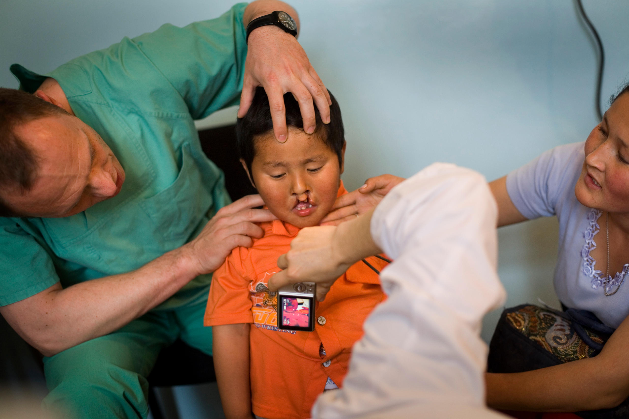 Epuipe médicale autour d un enfant avec un bec-de-lièvre
