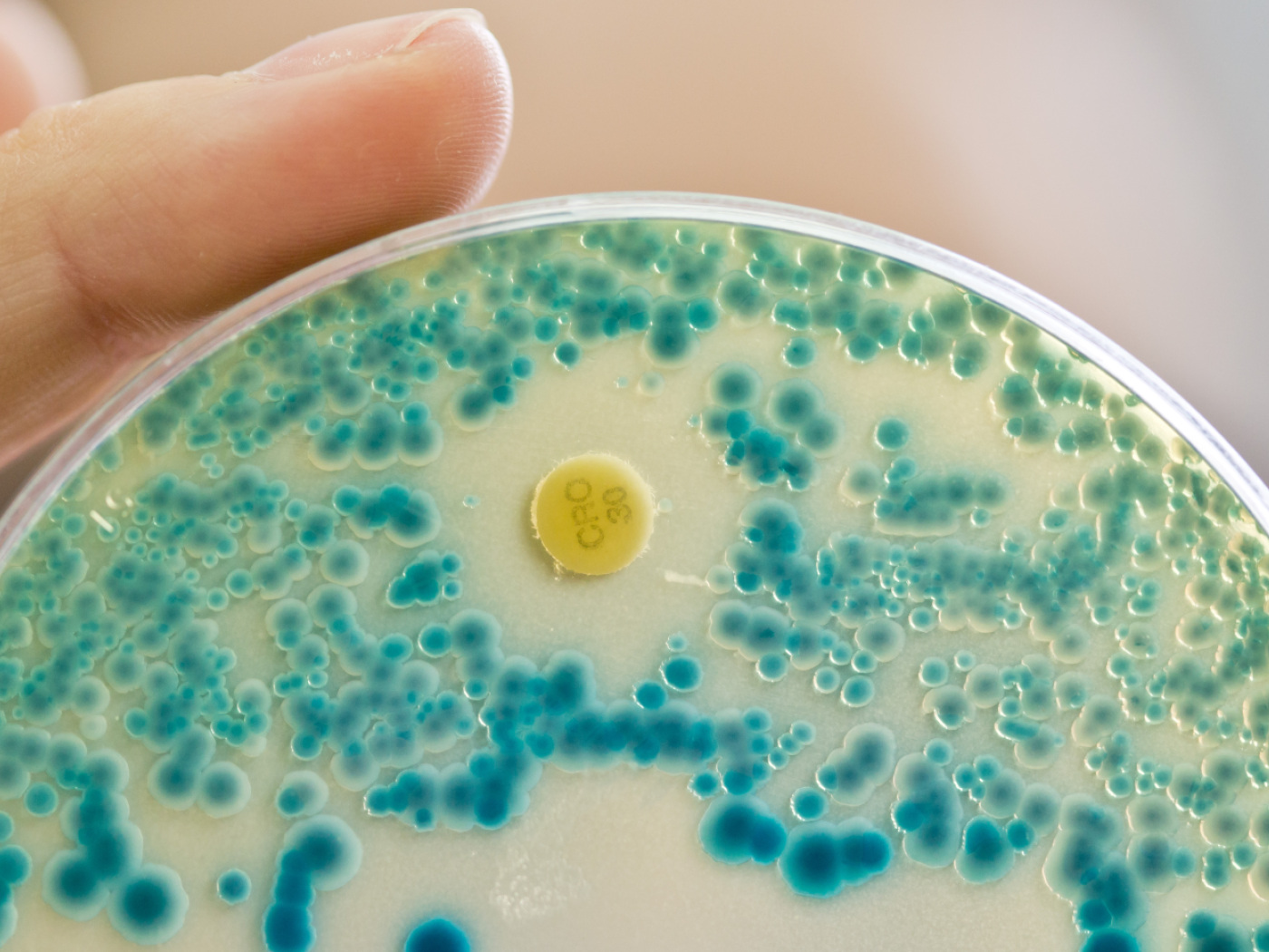 AI can help detect antibiotic-resistant bacteria