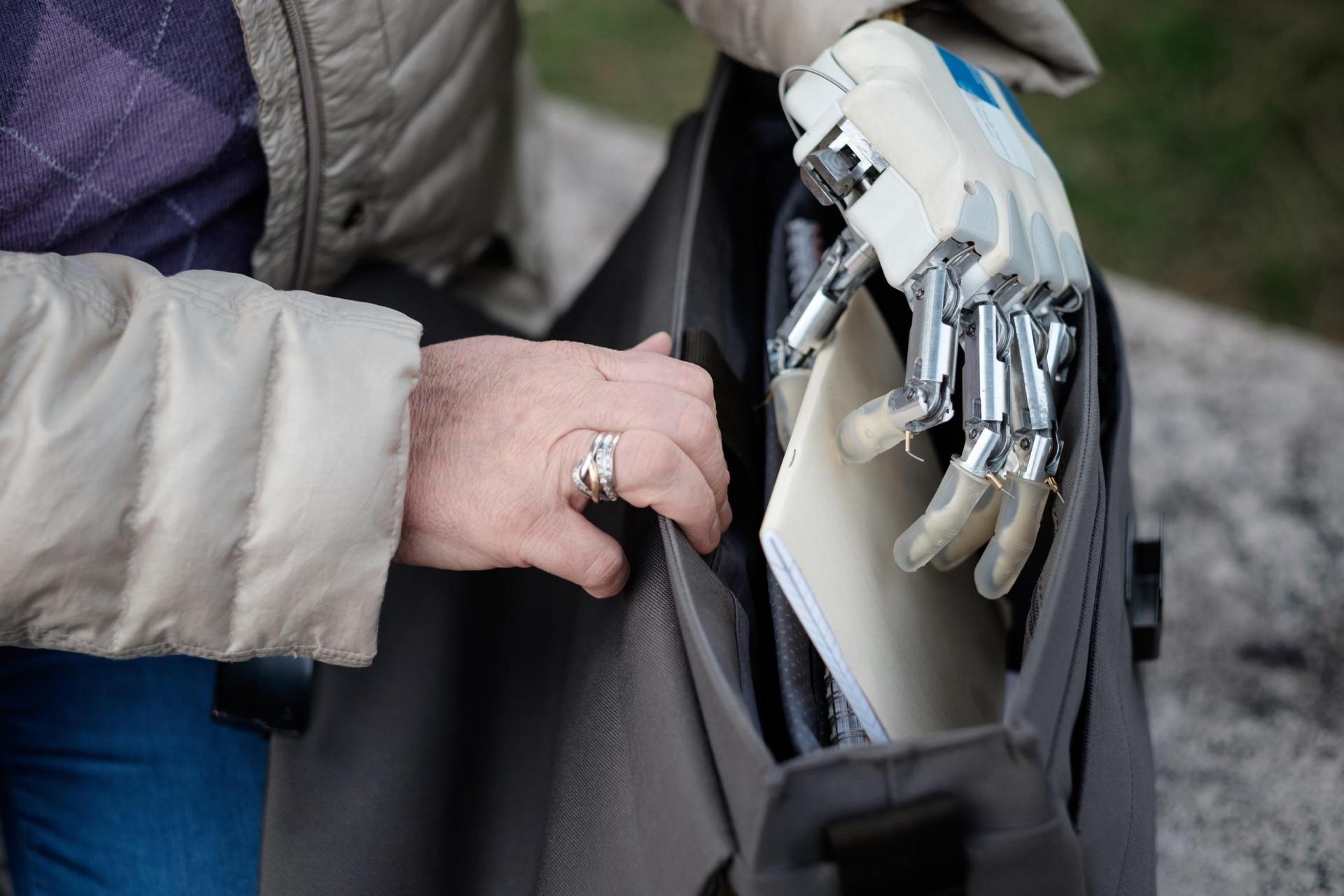 New Prosthetic Hand Can Sense Objects’ Form And Position - SWI Swissinfo.ch