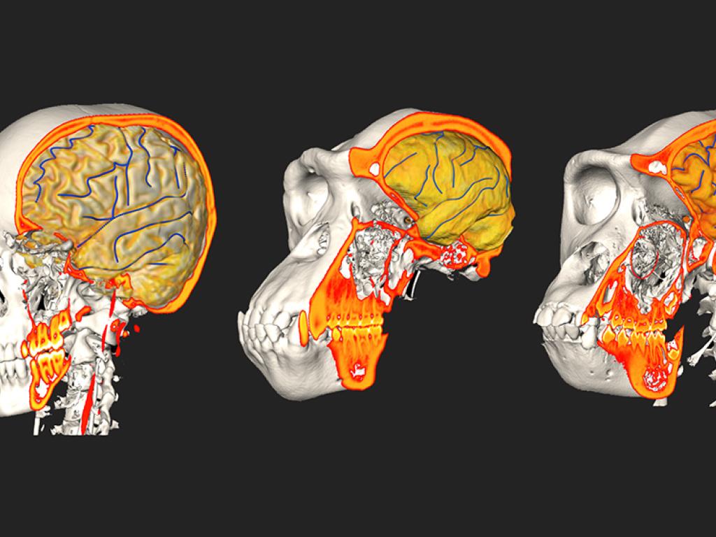 Crâne avec Cerveau, En 8 Parties - YLEA